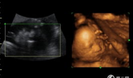 四维视频,四维视频揭秘未知世界